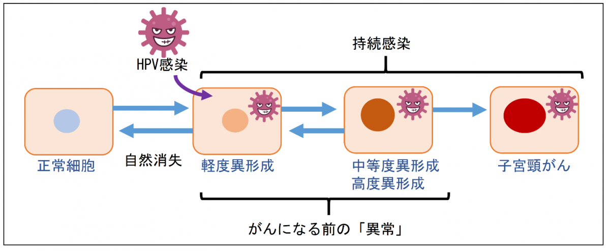 勃起不全の形而上学的な原因